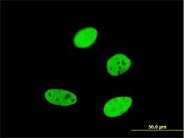 Anti-FOXA2 Antibody