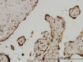 Anti-FOXA2 Antibody