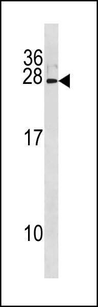 Anti-IFNA8 (C-term) Antibody