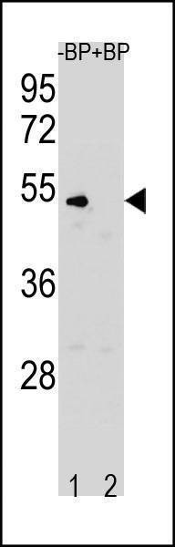 Anti-CCNB1 (N-term S9) Antibody