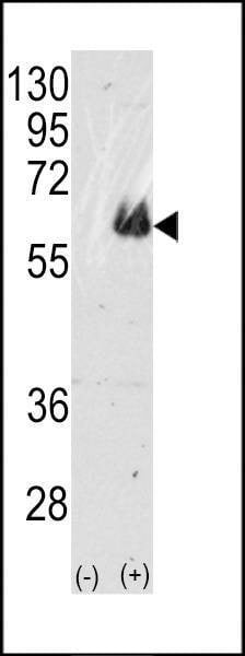 Anti-TAU (C-term) Antibody