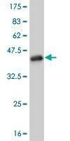 Anti-FOXC2 Antibody