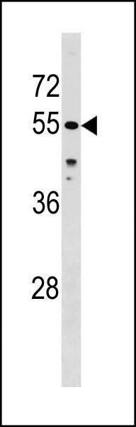 Anti-CHEK1 (Center S296) Antibody