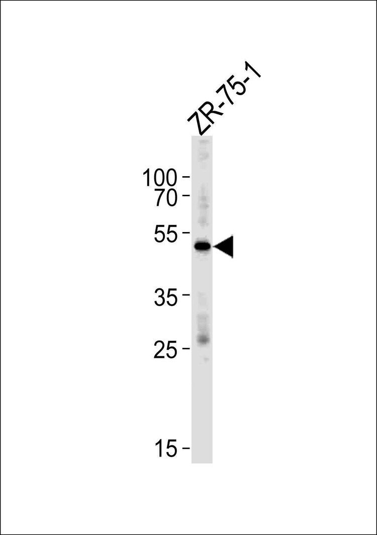 Anti-AGTR1 (C-term Y319) Antibody
