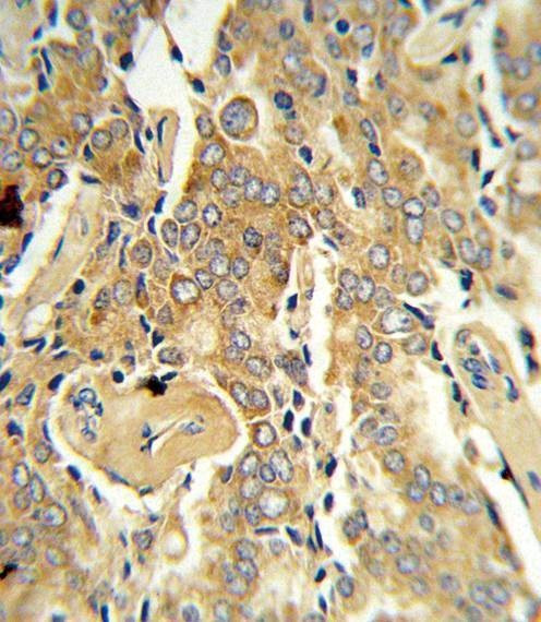 Anti-VEGFC Antibody