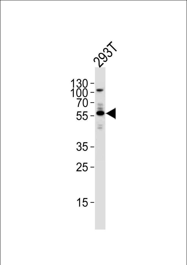 Anti-VEGFC Antibody