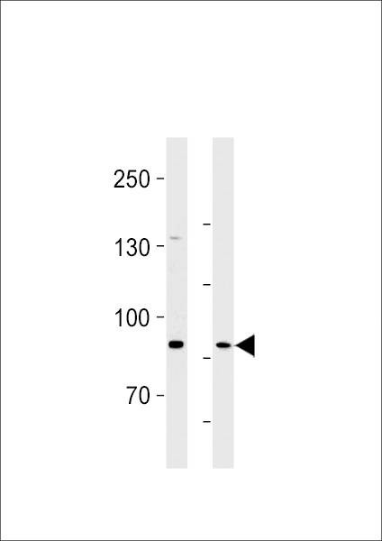 Anti-SEMA6B (C-term) Antibody