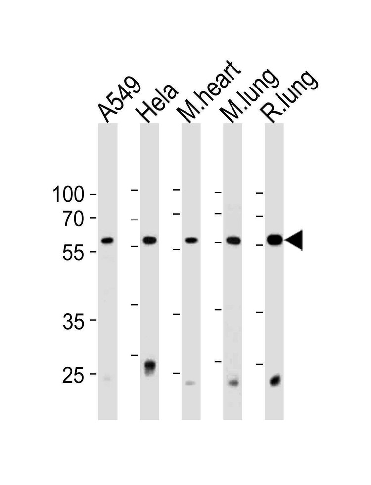 Anti-PRS4 (C-term) Antibody