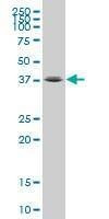Anti-FOXL1 Antibody