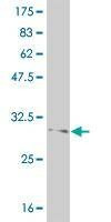 Anti-FOXL1 Antibody