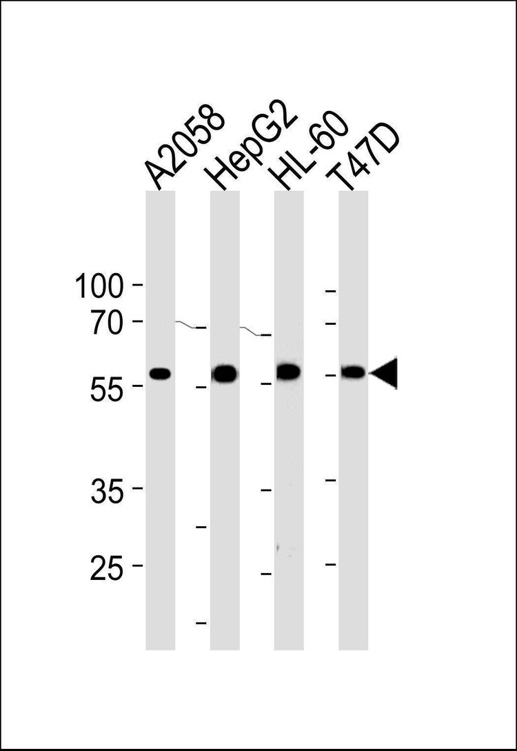Anti-GRN (C-term) Antibody