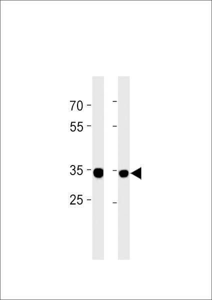 Anti-RPLP0P6 (N-term) Antibody