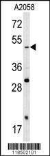 Anti-SOX4 (N-term) Antibody