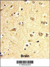 Anti-SOX4 (Center) Antibody
