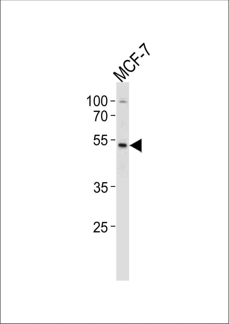 Anti-SOX4 (Center) Antibody