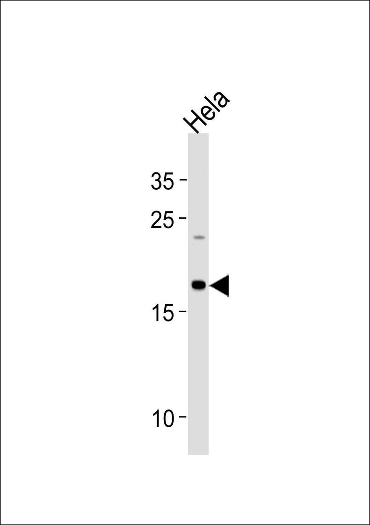Anti-NDUFB10 (Center) Antibody