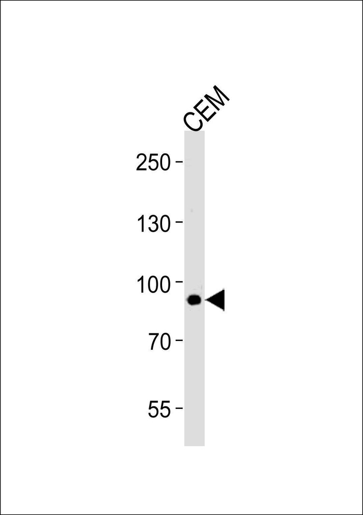 Anti-MATN2 (C-term) Antibody