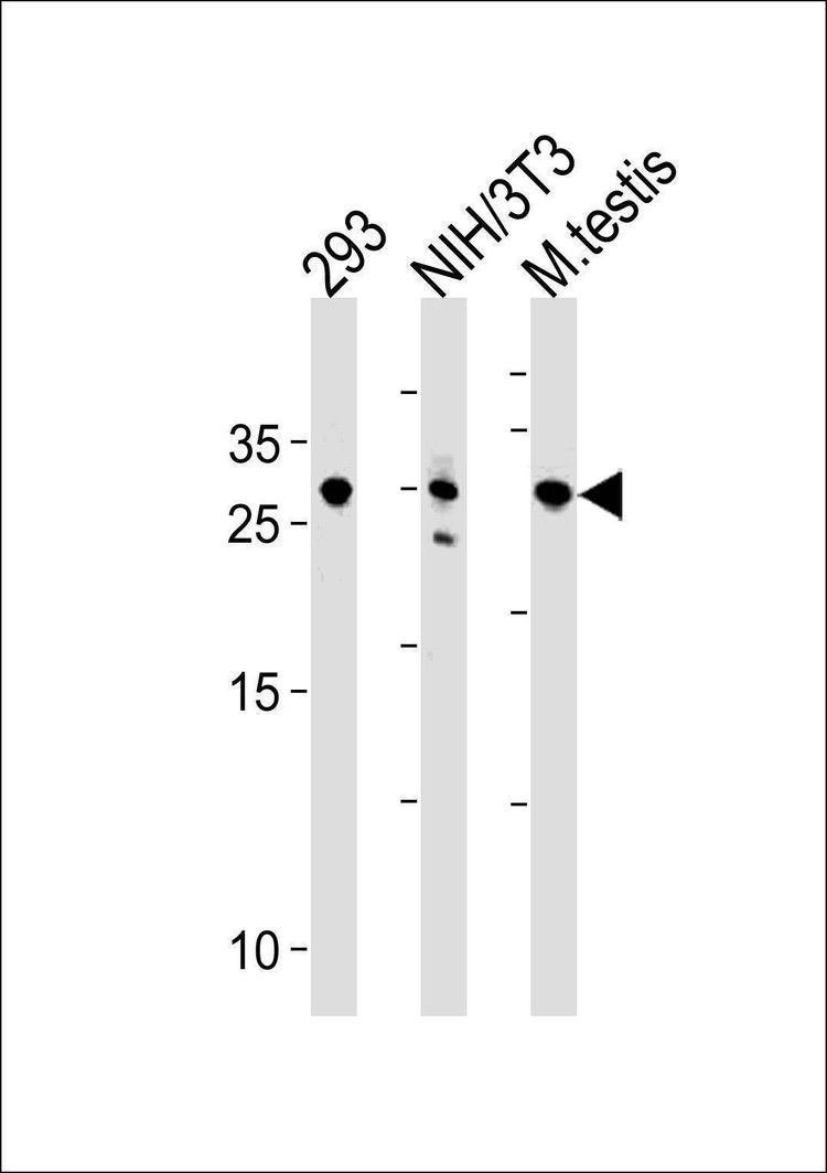 Anti-RNF166 (Center) Antibody