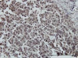 Anti-FOXO3A Antibody