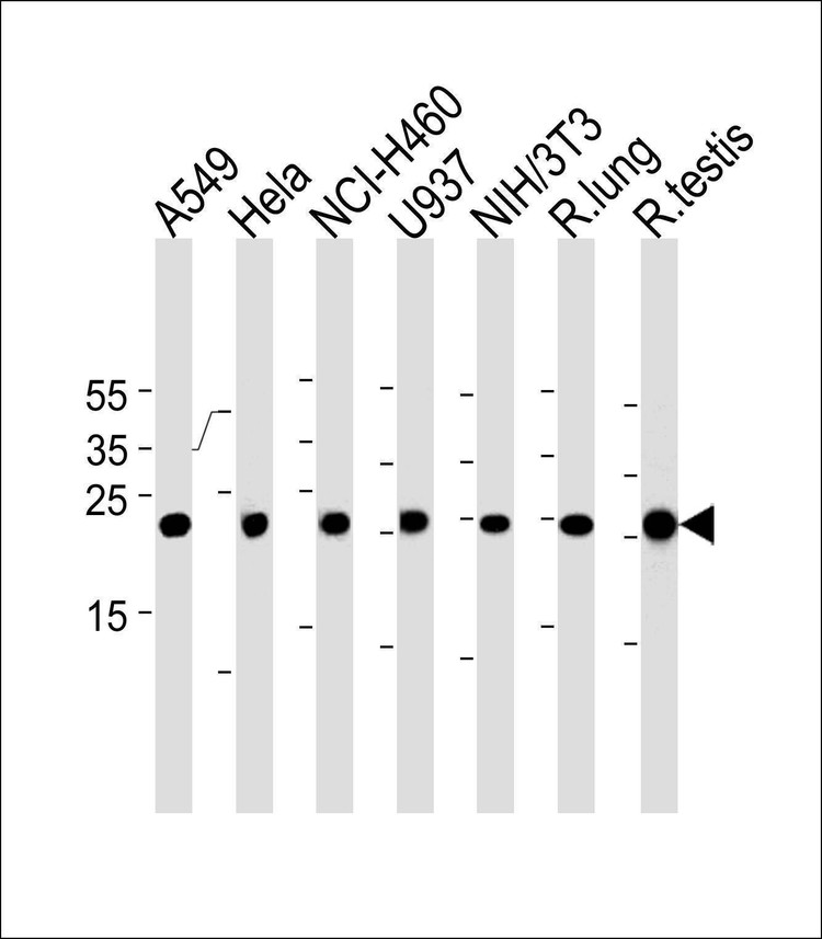 Anti-R Cebpd (Center) Antibody
