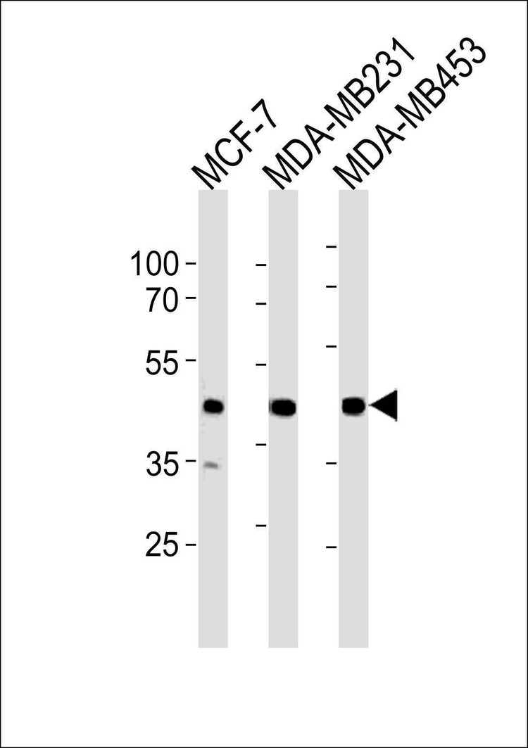 Anti-SGCG (Center) Antibody