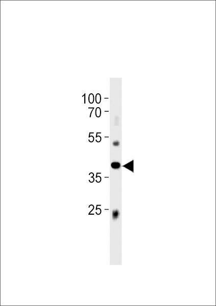 Anti-Mouse M Abi3 (C-term) Antibody