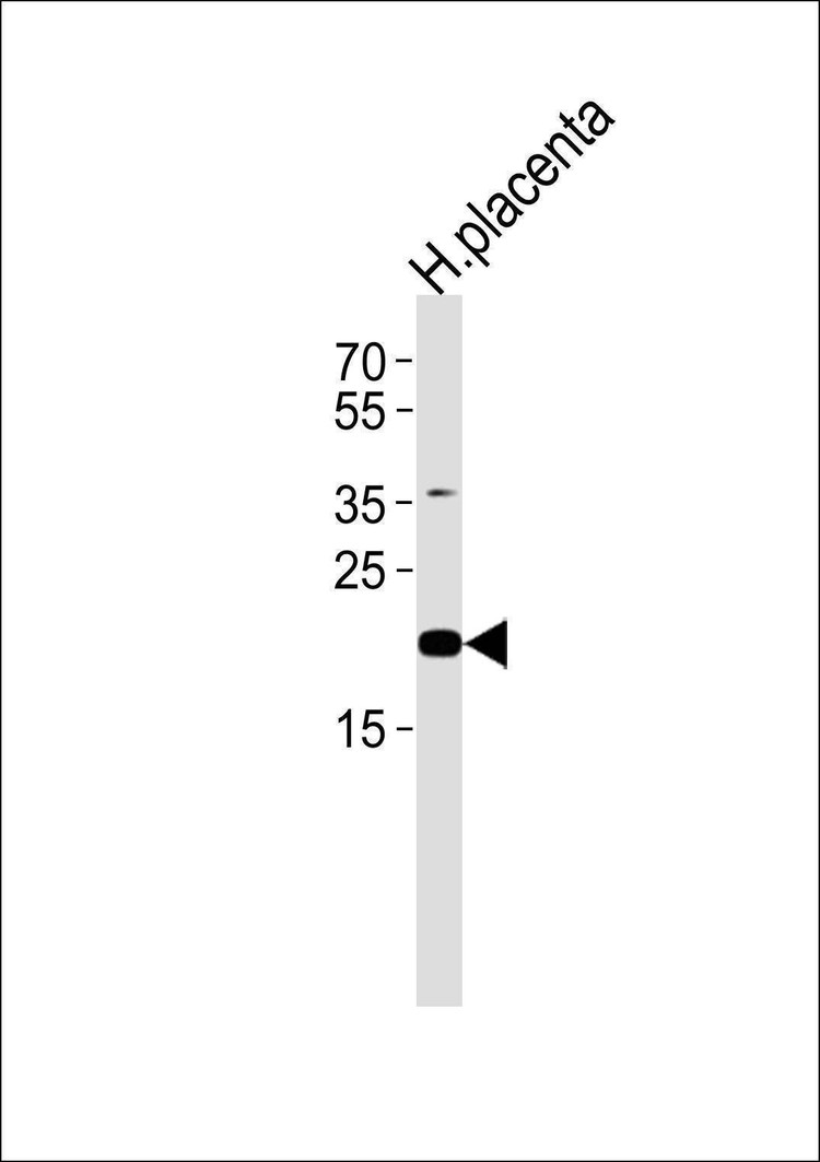 Anti-C2orf74 (C-term) Antibody