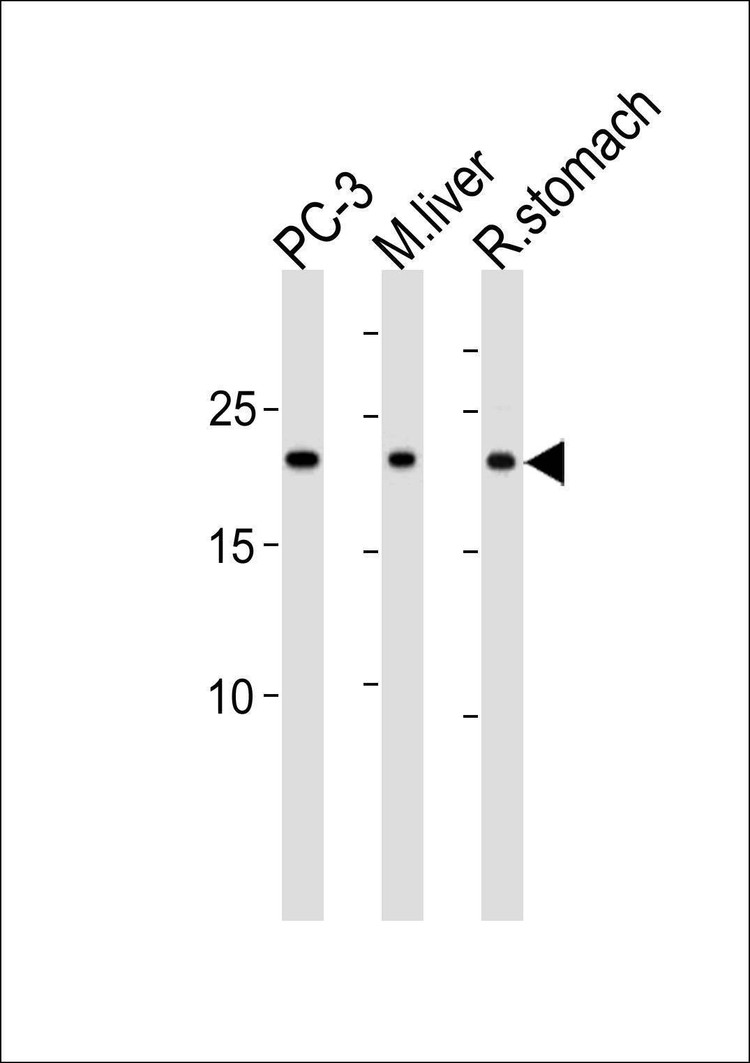 Anti-PSMB2 (C-term) Antibody