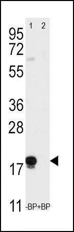 Anti-THY1 (N-term) Antibody