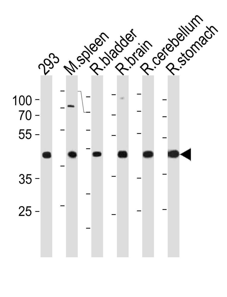 Anti-R Ccdc89 (Center) Antibody