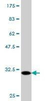 Anti-FPR2 Antibody