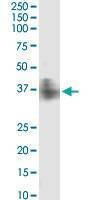 Anti-FPR2 Antibody