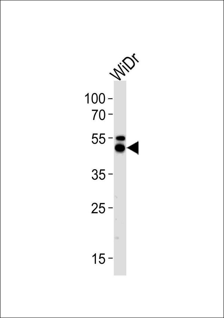 Anti-KRT20 (C-term) Antibody