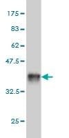 Anti-FTCD Antibody