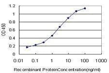 Anti-FTCD Antibody