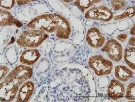 Anti-FTCD Antibody