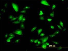 Anti-FTCD Antibody
