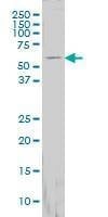 Anti-FTCD Antibody