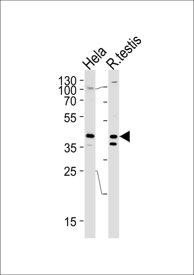 Anti-KHDRBS2 (C-term) Antibody