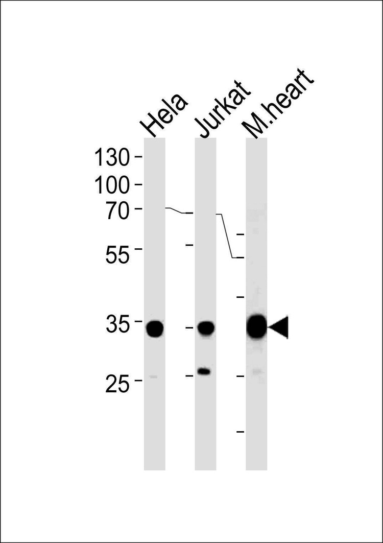 Anti-NDUFA9 (Center) Antibody