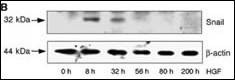 Anti-SNAIL (N-term D24) Antibody