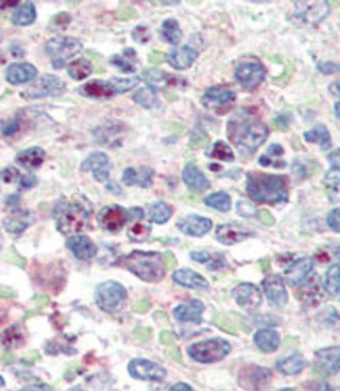 Anti-SNAIL (N-term D24) Antibody