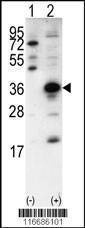 Anti-SNAI1 (N-term) Antibody