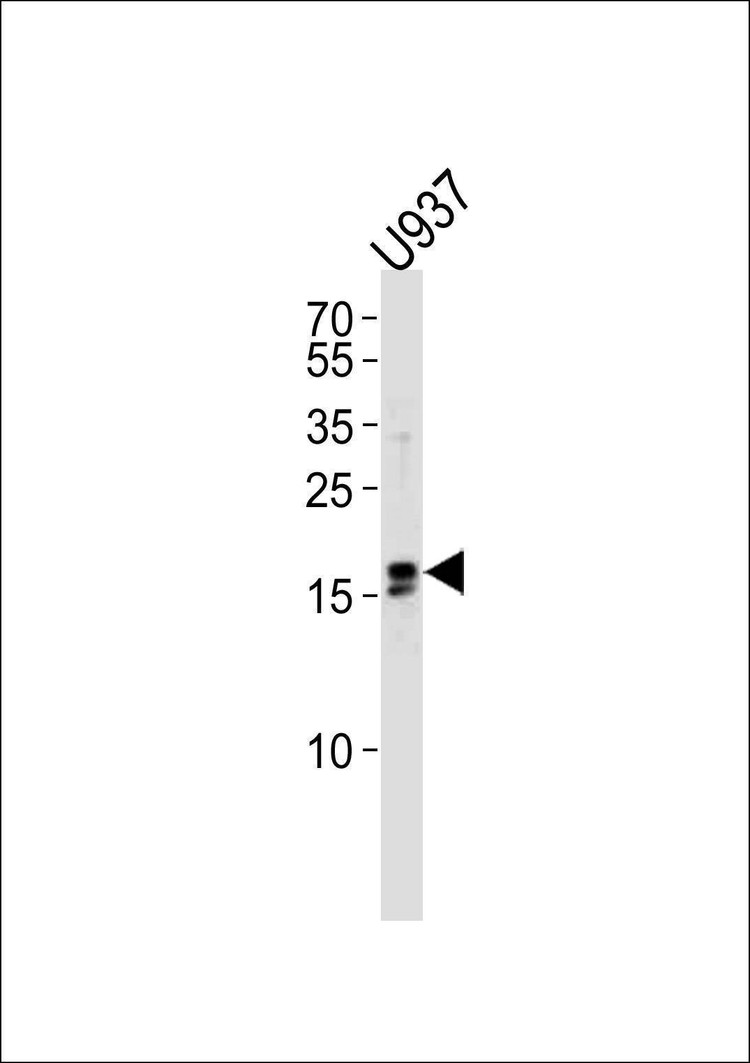 Anti-IQCF6 (N-term) Antibody