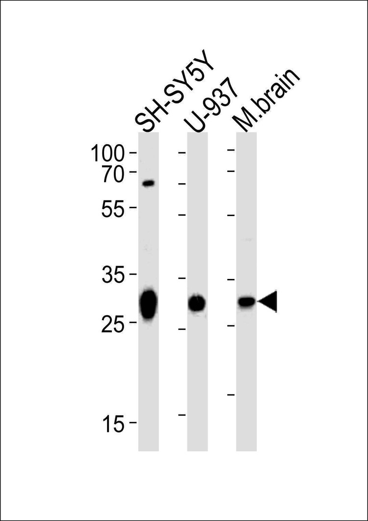 Anti-ANP32E (N-term) Antibody