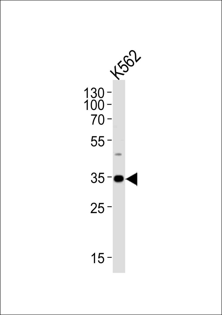 Anti-BBS5 (Center) Antibody