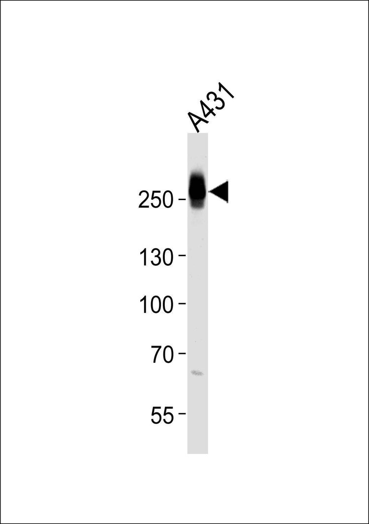 Anti-MYH14 (Center) Antibody