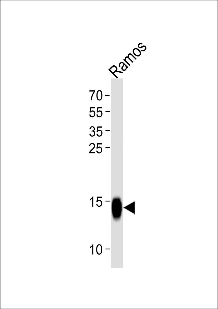 Anti-TCL1A (Center) Antibody