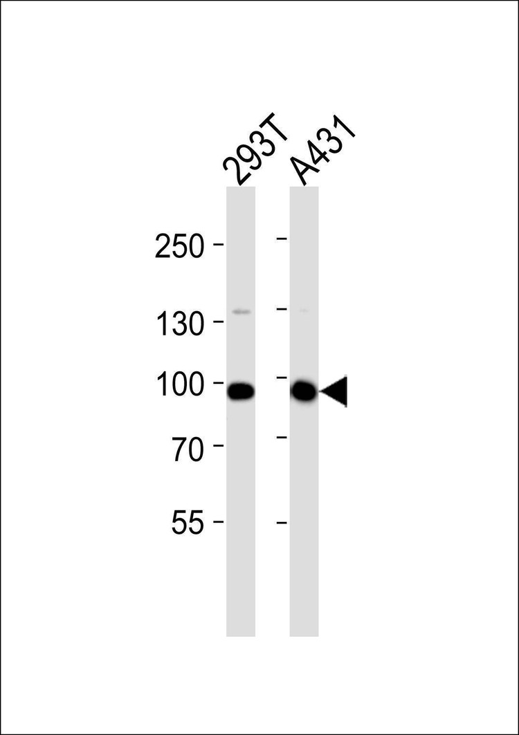 Anti-IL4R (C-term) Antibody