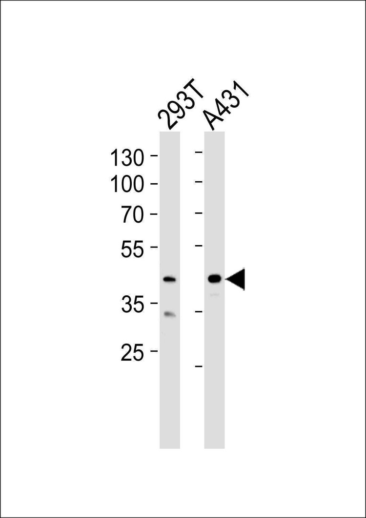 Anti-CSNK2A1 (Center) Antibody
